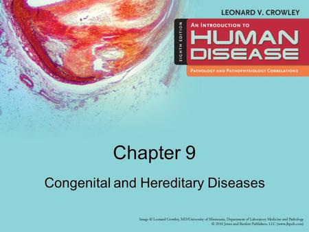 Congenital and Hereditary Diseases