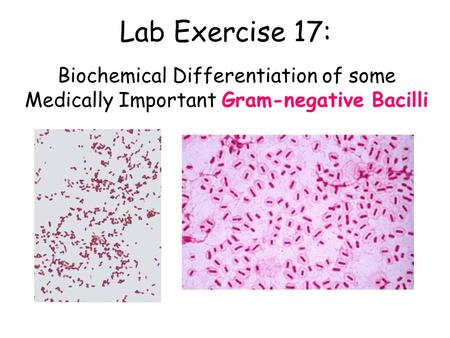 Lab Exercise 17: Biochemical Differentiation of some Medically Important Gram-negative Bacilli.