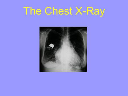 The Chest X-Ray.