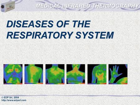 © EDP Srl, 2004  DISEASES OF THE RESPIRATORY SYSTEM.