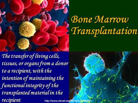 Bone Marrow Transplantation The transfer of living cells, tissues, or organs from a donor to a recipient, with the.