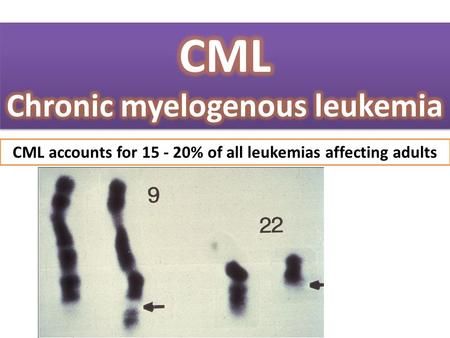 CML Chronic myelogenous leukemia