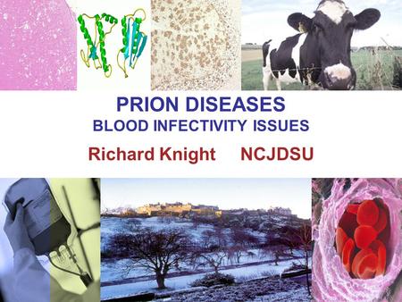 PRION DISEASES BLOOD INFECTIVITY ISSUES Richard Knight NCJDSU.