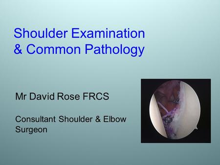 Shoulder Examination & Common Pathology