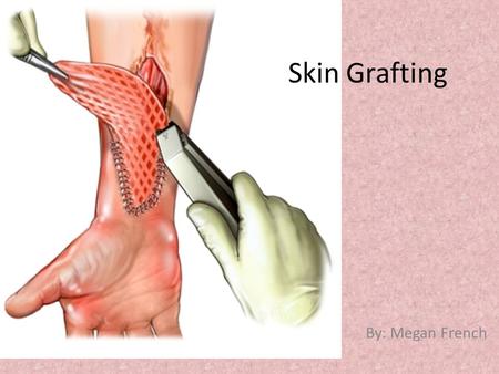 Skin Grafting By: Megan French. The Skin  The skin is the largest organ of the body  3 main layers : Epidermis, Dermis, Subcutaneous  Regulates body.
