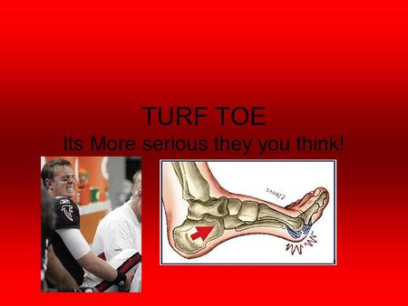 TURF TOE Its More serious they you think!. Anatomical structures (Muscles) Over 100 muscles, tendons Tibialis Anterior- Dorsiflexes foot and inverts foot.