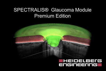 SPECTRALIS® Glaucoma Module Premium Edition