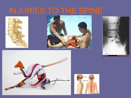 INJURIES TO THE SPINE. What is the injury? Most spinal cord injuries are a result from catastrophic falls, car accidents, sports related, or any kind.