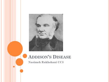 Addison’s Disease Nasimeh Rakhshani CC3.