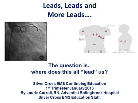 Leads, Leads and More Leads….