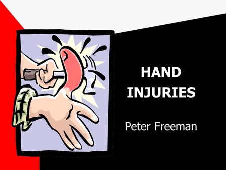 HAND INJURIES Peter Freeman. ESSENTIALS A thorough knowledge of hand anatomy and function is essential for proper management of the injured hand Most.