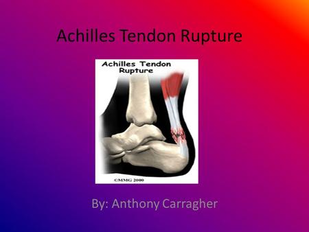 Achilles Tendon Rupture By: Anthony Carragher. What is the Achilles tendon? The Achilles tendon is a large ropelike band of fibrous tissue in the back.