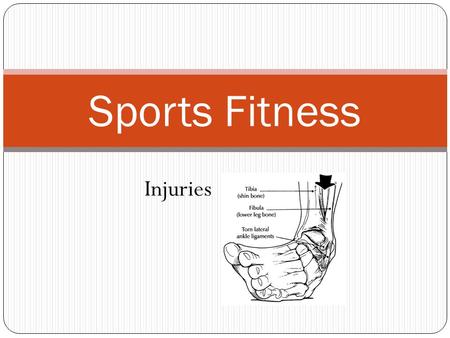 Sports Fitness Injuries. Session 13 Objectives The student will learn how to define, identify, and treat the basic sports injuries associated with wellness.