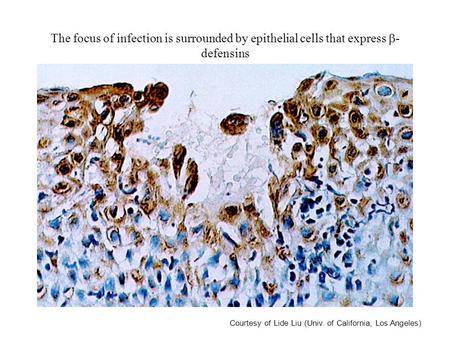 The focus of infection is surrounded by epithelial cells that express  - defensins Courtesy of Lide Liu (Univ. of California, Los Angeles)