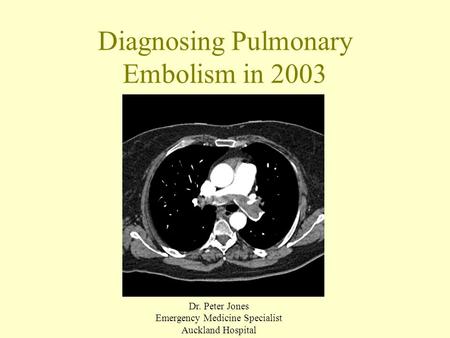 Diagnosing Pulmonary Embolism in 2003 Dr. Peter Jones Emergency Medicine Specialist Auckland Hospital.