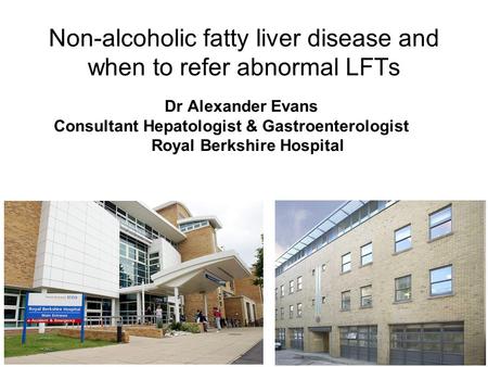 Non-alcoholic fatty liver disease and when to refer abnormal LFTs