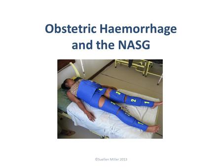 Obstetric Haemorrhage and the NASG ©Suellen Miller 2013.