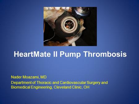 Nader Moazami, MD Department of Thoracic and Cardiovascular Surgery and Biomedical Engineering, Cleveland Clinic, OH HeartMate II Pump Thrombosis.