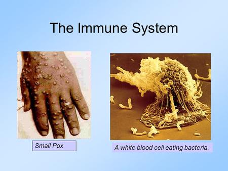The Immune System Small Pox A white blood cell eating bacteria.