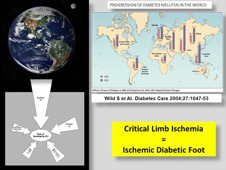 PROGRESSION OF DIABETES MELLITUS IN THE WORLD Critical Limb Ischemia = Ischemic Diabetic Foot Critical Limb Ischemia = Ischemic Diabetic Foot Wild S et.