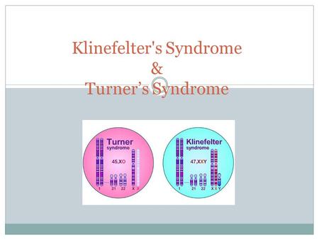 Klinefelter's Syndrome & Turner’s Syndrome. Cause of Kleinfelter’s Male has extra Chromosome Known as XXY male Male has total of 47 chromosomes.