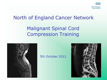 North of England Cancer Network Malignant Spinal Cord Compression Training 5th October 2012.