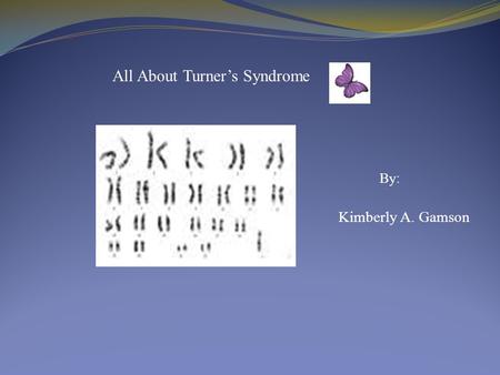 Kimberly A. Gamson All About Turner’s Syndrome By :