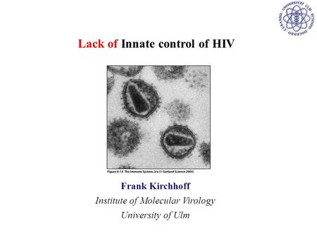 Lack of Innate control of HIV