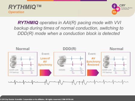 RYTHMIQ™ Operation RYTHMIQ operates in AAI(R) pacing mode with VVI backup during times of normal conduction, switching to DDD(R) mode when a conduction.