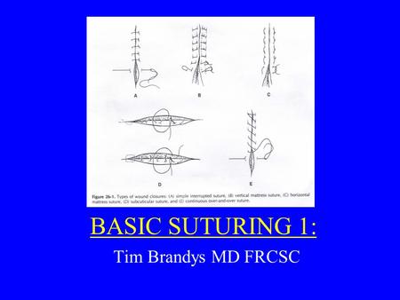 BASIC SUTURING 1: Tim Brandys MD FRCSC. Principles of Wound Closure: 1.Equal Bites on each side of the wound 2.Distance between sutures = distance suture.