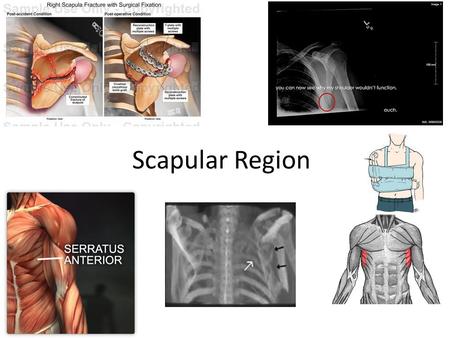 Scapular Region artmiller.medicalillustration.com.