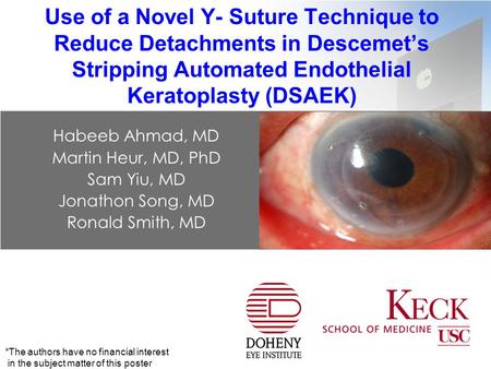 Use of a Novel Y- Suture Technique to Reduce Detachments in Descemet’s Stripping Automated Endothelial Keratoplasty (DSAEK) Habeeb Ahmad, MD Martin Heur,