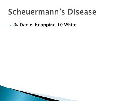  By Daniel Knapping 10 White. Scheuermann’s disease is generally caused because people slouch while playing games, watching TV or being on the computer.