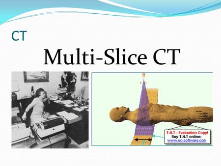CT Multi-Slice CT.