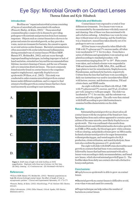 Eye Spy: Microbial Growth on Contact Lenses Theresa Edson and Kyle Hilsabeck Introduction: Biofilms are “organized microbial systems consisting of layers.