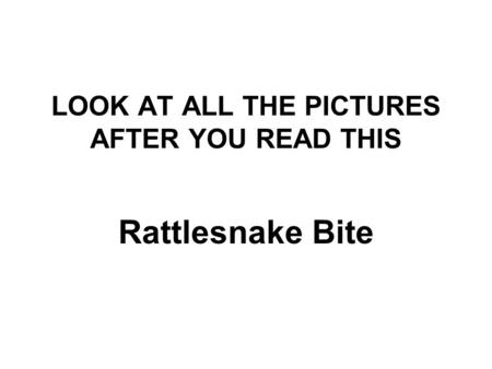 LOOK AT ALL THE PICTURES AFTER YOU READ THIS Rattlesnake Bite.