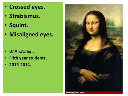 Crossed eyes. Strabismus. Squint. Misaligned eyes. Dr.Ali.A.Taqi.