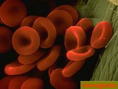 Dr Gihan Gawish Hemoglobin. Dr Gihan Gawish Hemoglobin   Synthesized in RBC precursor cells: reticulocytes and erythroblasts   Synthesis is tightly.