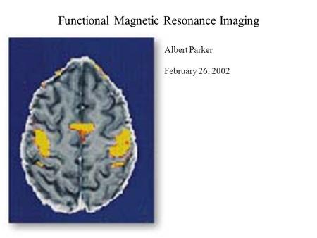 Functional Magnetic Resonance Imaging Albert Parker February 26, 2002.