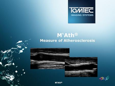 M‘Ath ® M‘Ath ® Measure of Atherosclerosis. M‘Ath ®
