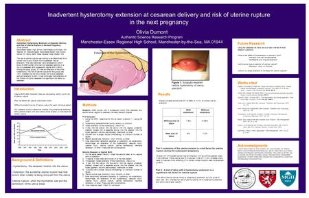 Inadvertent hysterotomy extension at cesarean delivery and risk of uterine rupture in the next pregnancy Olivia Dumont Authentic Science Research Program.