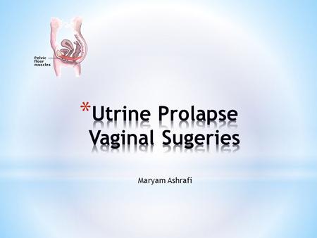 Maryam Ashrafi. * ratio surgery for prolapse vs incontinence: 2:1 * prevalence of 31% in women aged 29-59 yrs * 20% of women on gynecology waiting lists.