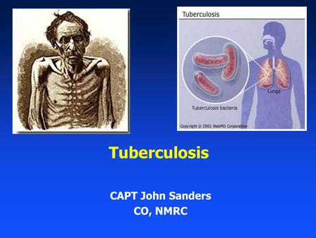 Tuberculosis CAPT John Sanders CO, NMRC. 2 Outline Importance of TB Clinical Overview of TB Active vs. Latent TB Active TB diagnosis and treatment LTBI.