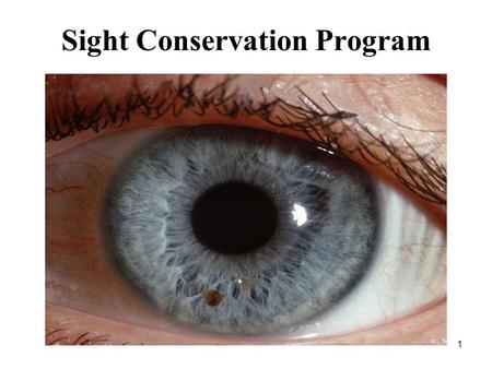 1 Sight Conservation Program. 2 Overview MC policy Identify eye hazardous areas by conducting an industrial hygiene survey Post signs Provide personnel.