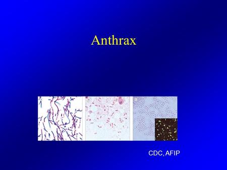 Anthrax CDC, AFIP. Diseases of Bioterrorist Potential Learning Objectives Describe the epidemiology, mode of transmission and presenting symptoms of disease.