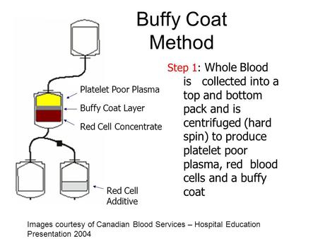 Buffy Coat Method Platelet Poor Plasma Step 1: Whole Blood is collected into a top and bottom pack and is centrifuged (hard spin) to produce platelet poor.