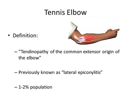 Tennis Elbow Definition: – “Tendinopathy of the common extensor origin of the elbow” – Previously known as “lateral epiconylitis” – 1-2% population.