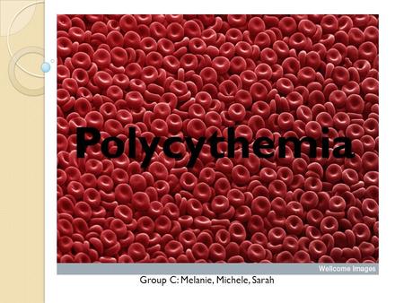 Polycythemia Group C: Melanie, Michele, Sarah.