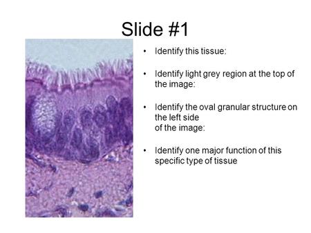 Slide #1 Identify this tissue: Identify light grey region at the top of the image: Identify the oval granular structure on the left side of the image: