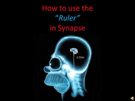 How to use the “Ruler” in Synapse Right Click & choose “Ruler”